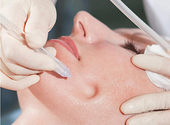 Пилинг лица. Ultra Подарки Ульяновск. Подарочный сертификат на натуральную пилинг лица. Ultra Подарки Ульяновск. 8 800-505-9503. Пилинг лица  #вМоскве#, чистка лица, очищение лица, химический пилинг