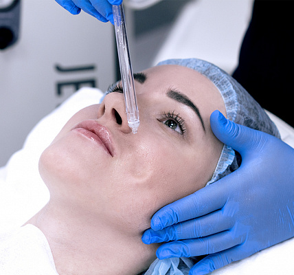 Пилинг лица. Ultra Подарки Ульяновск. Подарочный сертификат на натуральную пилинг лица. Ultra Подарки Ульяновск. 8 800-505-9503. Пилинг лица  #вМоскве#, чистка лица, очищение лица, химический пилинг